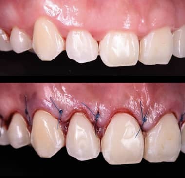 Slider image (5) Easy Dental